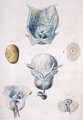 Diseases of the bladder and prostate, from 'Anatomie Pathologique du Corps Humain' - Antoine Chazal