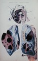 Apoplexy of the heart and of the lungs, illustration plate from 