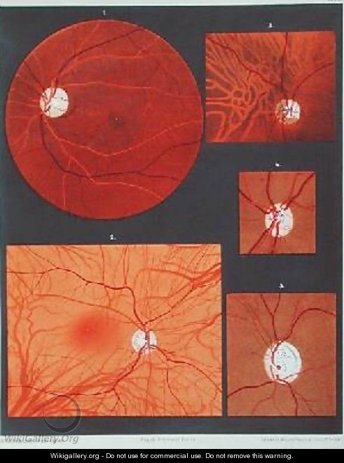 The eye seen through a microscope - (after) Liebreich, Richard