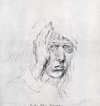Self-Portrait with Bandage - Albrecht Durer