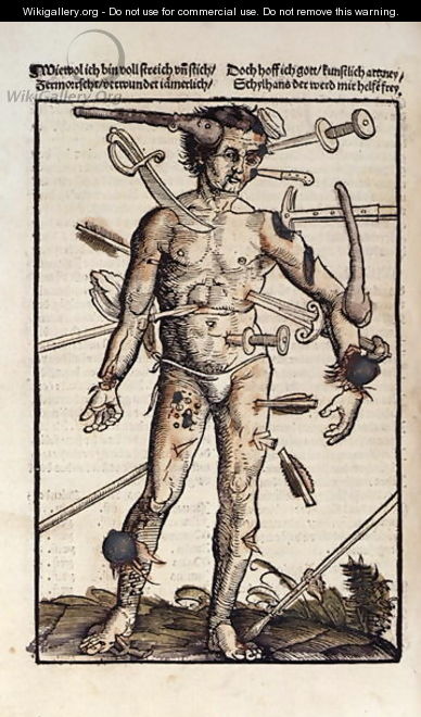 XVIIIv The Wound Man, from the Feldtbuch der Wundartzney by Hans von Gersdorff, 1517 - Hans or Johannes Ulrich Wechtlin
