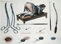 An operation on a vesicovaginal fistula - Nicolas Henri Jacob
