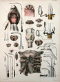 Tracheotomy operation, plate from Traite Complet de lAnatomie de lHomme by Jean-Baptiste Marc Bourgery 1797-1849 1866-67 - E. Pochet