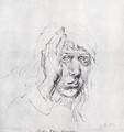 Self-Portrait with Bandage - Albrecht Durer